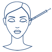Fillers = Esthetiek